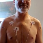 Read more about the article 5th Day Post Op